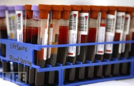 Sanita'. I laboratori di analisi accreditati alla Regione sul piede di guerra