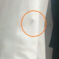 cani randagi aggressione donna russello 2