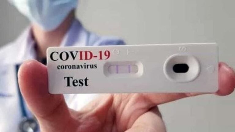 test sierologico coronavirus-2-2-2